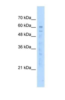 Western Blot: KIAA0494 Antibody [NBP1-59967] - HepG2 tissue lysate at a concentration of 5ug/ml.