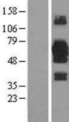 Western Blot: KIAA0494 Overexpression Lysate (Adult Normal) [NBL1-12248] Left-Empty vector transfected control cell lysate (HEK293 cell lysate); Right -Over-expression Lysate for KIAA0494.