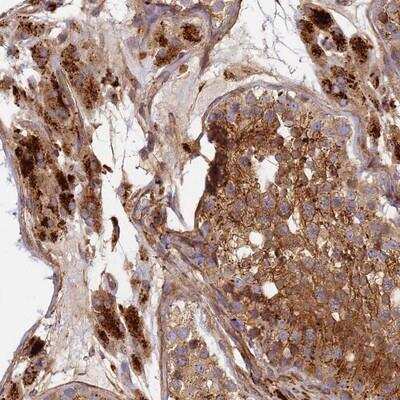 Immunohistochemistry-Paraffin: KIAA0528 Antibody [NBP1-92050] - Staining of human testis shows strong cytoplasmic positivity in cells in seminiferus ducts and Leydig cells.