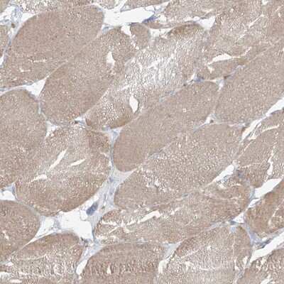 Immunohistochemistry-Paraffin: KIAA0556 Antibody [NBP1-91006] - Staining of human skeletal muscle shows low expression as expected.