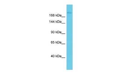 Western Blot: KIAA0556 Antibody [NBP2-85146] - Host: Rabbit. Target Name: KIAA0556. Sample Type: NCI-H226 Whole Cell lysates. Antibody Dilution: 1.0ug/mlKIAA0556 is supported by BioGPS gene expression data to be expressed in NCIH226