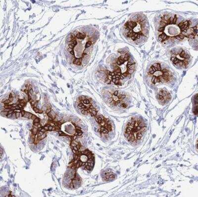 Immunohistochemistry VWA8 Antibody - BSA Free