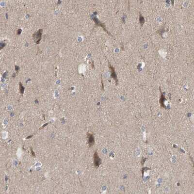 Immunohistochemistry-Paraffin: KIAA0753/MNR Antibody [NBP1-90929] - Staining of human cerebral cortex shows weak to moderate cytoplasmic positivity in neurons.