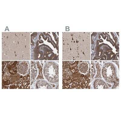 Immunohistochemistry-Paraffin: KIAA0753/MNR Antibody [NBP1-90929] - Staining of human cerebral cortex, fallopian tube, kidney and testis using Anti-KIAA0753 antibody NBP1-90929 (A) shows similar protein distribution across tissues to independent antibody NBP1-90931 (B).