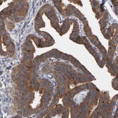 Immunohistochemistry-Paraffin: KIAA0753/MNR Antibody [NBP1-90929] - Staining of human Fallopian tube shows strong cytoplasmic positivity in glandular cells.