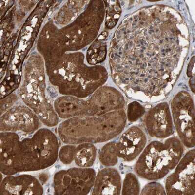 Immunohistochemistry-Paraffin: KIAA0753/MNR Antibody [NBP1-90929] - Staining of human kidney shows strong cytoplasmic positivity in cells in tubules.