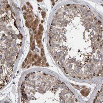 Immunohistochemistry-Paraffin: KIAA0753/MNR Antibody [NBP1-90929] - Staining of human testis shows strong cytoplasmic positivity in Leydig cells.