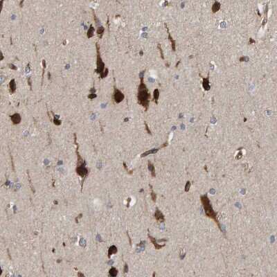 Immunohistochemistry-Paraffin: KIAA0753/MNR Antibody [NBP1-90931] - Staining of human cerebral cortex shows strong cytoplasmic positivity in neurons.