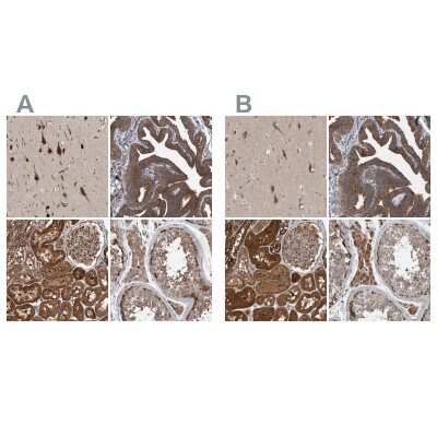 Immunohistochemistry-Paraffin: KIAA0753/MNR Antibody [NBP1-90931] - Staining of human cerebral cortex, fallopian tube, kidney and testis using Anti-KIAA0753 antibody NBP1-90931 (A) shows similar protein distribution across tissues to independent antibody NBP1-90929 (B).