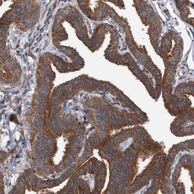 Immunohistochemistry-Paraffin: KIAA0753/MNR Antibody [NBP1-90931] - Staining of human Fallopian tube shows strong cytoplasmic positivity in glandular cells.