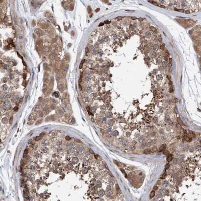 Immunohistochemistry-Paraffin: KIAA0753/MNR Antibody [NBP1-90931] - Staining of human testis shows moderate cytoplasmic positivity in Leydig cells.