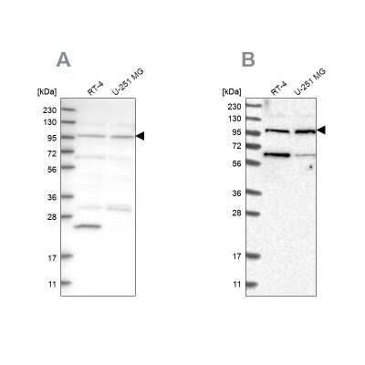 <b>Independent Antibodies Validation. </b>Western Blot: KIAA0753/MNR Antibody [NBP1-90929] - Analysis using Anti-KIAA0753 antibody NBP1-90929 (A) shows similar pattern to independent antibody NBP1-90931 (B).