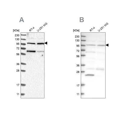 Western Blot: KIAA0753/MNR Antibody [NBP1-90931] - Analysis using Anti-KIAA0753 antibody NBP1-90931 (A) shows similar pattern to independent antibody NBP1-90929 (B).