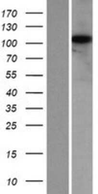 Western Blot: KIAA0753 Overexpression Lysate (Adult Normal) [NBP2-07273] Left-Empty vector transfected control cell lysate (HEK293 cell lysate); Right -Over-expression Lysate for KIAA0753.