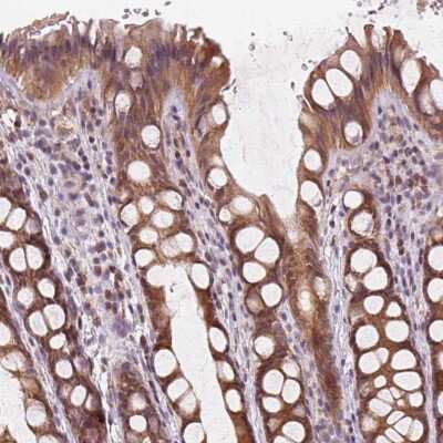 Immunohistochemistry-Paraffin KIAA0895L Antibody - BSA Free