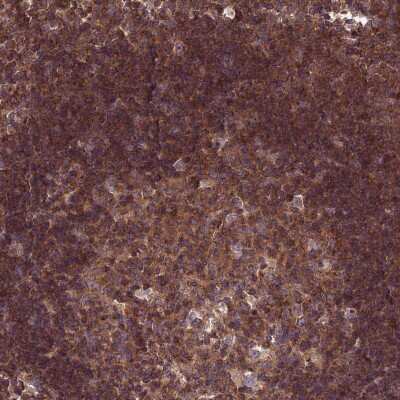 Immunohistochemistry-Paraffin: KIAA0922 Antibody [NBP2-30898] - Staining of human lymph node shows cytoplasmic positivity in germinal center cells and non-germinal center cells.