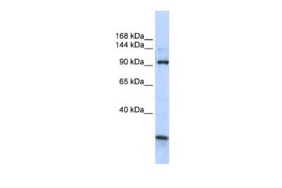Western Blot: KIAA1024 Antibody [NBP2-83109] - WB Suggested Anti-KIAA1024 Antibody Titration: 0.2-1 ug/ml. ELISA Titer: 1:312500. Positive Control: Human brain