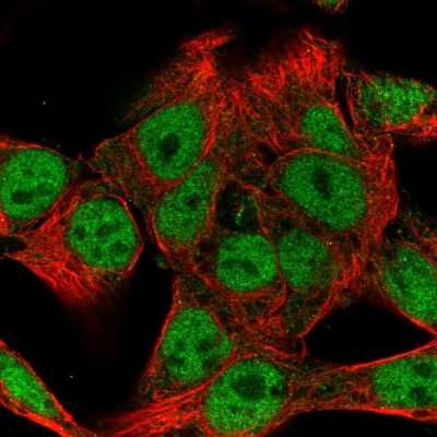 Immunocytochemistry/ Immunofluorescence WASHC4 Antibody