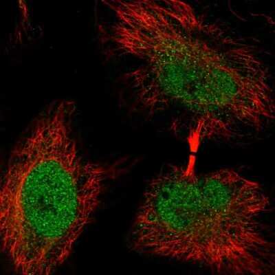 Immunocytochemistry/ Immunofluorescence WASHC4 Antibody