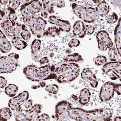 Immunohistochemistry-Paraffin WASHC4 Antibody