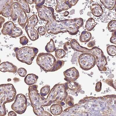 Immunohistochemistry-Paraffin: KIAA1033 Antibody [NBP2-47410] - Staining of human placenta shows cytoplasmic and membranous positivity in trophoblastic cells.