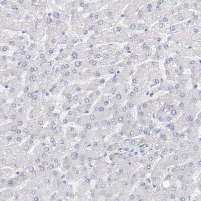 Immunohistochemistry-Paraffin KIAA1109/FSA Antibody