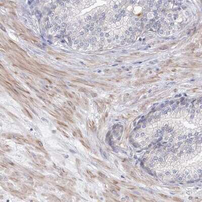 Immunohistochemistry-Paraffin: KIAA1109/FSA Antibody [NBP1-82145] - Staining of human prostate shows weak cytoplasmic positivity in smooth muscle cells.