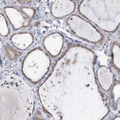 Immunohistochemistry-Paraffin: KIAA1109/FSA Antibody [NBP1-82145] - Staining of human thyroid gland shows moderate cytoplasmic positivity in glandular cells.