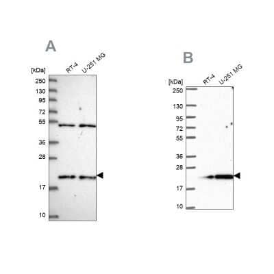 Western Blot: KIAA1143 Antibody [NBP1-92051] - Analysis using Anti-KIAA1143 antibody NBP1-92051 (A) shows similar pattern to independent antibody NBP2-57324 (B).