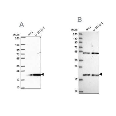 Western Blot KIAA1143 Antibody - BSA Free