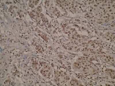 Immunohistochemistry-Paraffin CEMIP/KIAA1199 Antibody (V98P4E1*B7) - BSA Free