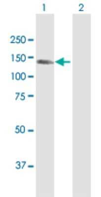 Western Blot: KIAA1199 Antibody [H00057214-D01P] - Analysis of KIAA1199 expression in transfected 293T cell line by KIAA1199 polyclonal antibody.Lane 1: KIAA1199 transfected lysate(110.40 KDa).Lane 2: Non-transfected lysate.