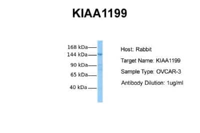 Western Blot CEMIP/KIAA1199 Antibody - BSA Free