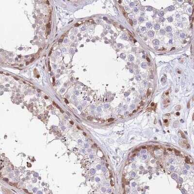 Immunohistochemistry-Paraffin: KIAA1211 Antibody [NBP2-30539] - Staining of human testis shows strong positivity in a subset of cells in seminiferous ducts.