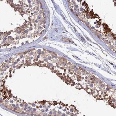 Immunohistochemistry-Paraffin: KIAA1211 Antibody [NBP2-30840] - Staining of human testis shows strong cytoplasmic positivity in seminiferous ducts.