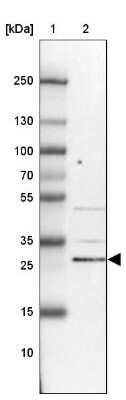 Western Blot KIAA1257 Antibody - BSA Free