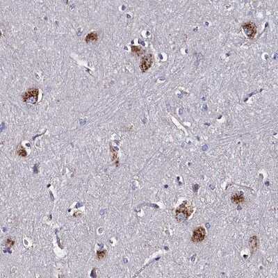 Immunohistochemistry-Paraffin: KIAA1324L Antibody [NBP1-94056] - Staining of human lateral ventricle shows strong cytoplasmic positivity in neurons.