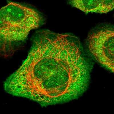 Immunocytochemistry/Immunofluorescence: CFAP97 Antibody [NBP2-47408] - Staining of human cell line U-2 OS shows localization to nucleoli, plasma membrane & cytosol. Antibody staining is shown in green.