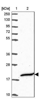 Western Blot: CFAP97 Antibody [NBP2-47408] - Lane 1: Marker  [kDa] 250, 130, 95, 72, 55, 36, 28, 17, 10.  Lane 2: Human cell line RT-4