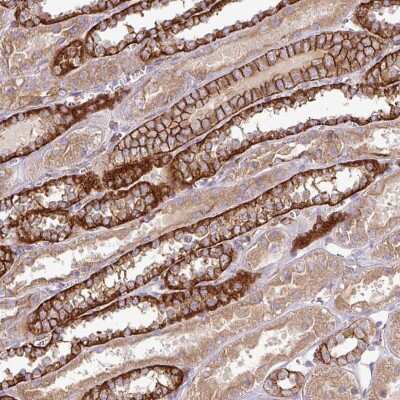 Immunohistochemistry-Paraffin: RIC1 Antibody [NBP2-49012] - KIAA1432 Antibody [NBP2-49012] - Staining of human kidney shows strong cytoplasmic and membranous positivity in cells in tubules.