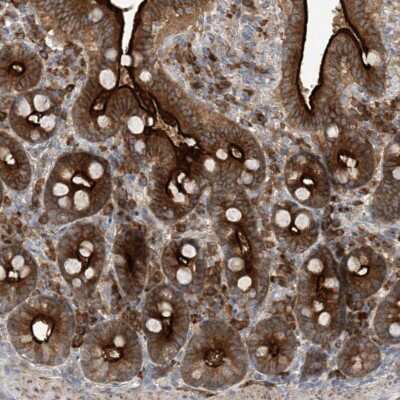 Immunohistochemistry-Paraffin: KIAA1522 Antibody [NBP1-90915] - Staining of human duodenum shows strong cytoplasmic and membranous  positivity in glandular cells.