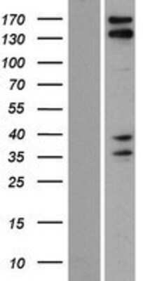 Western Blot: KIAA1543 Overexpression Lysate (Adult Normal) [NBP2-08492] Left-Empty vector transfected control cell lysate (HEK293 cell lysate); Right -Over-expression Lysate for KIAA1543.