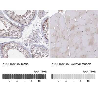 Immunohistochemistry-Paraffin: KIAA1586 Antibody [NBP1-86291] - Staining in human testis and skeletal muscle tissues using anti-KIAA1586 antibody. Corresponding KIAA1586 RNA-seq data are presented for the same tissues.