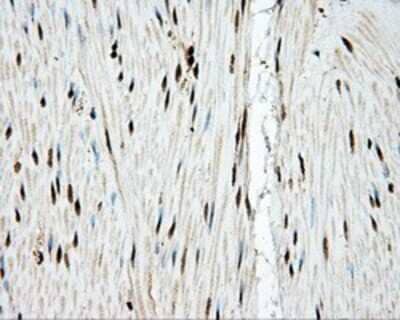 Immunohistochemistry-Paraffin: KIAA1609 Antibody (5D9) [NBP2-02352] - Staining of paraffin-embedded colon tissue using anti-KIAA1609 mouse monoclonal antibody.