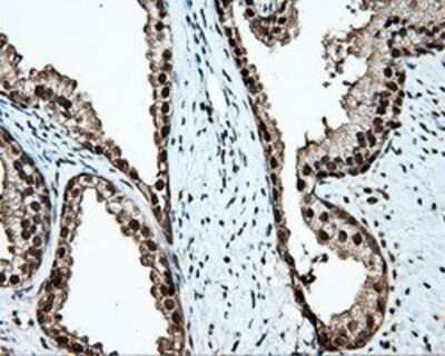 Immunohistochemistry-Paraffin: KIAA1609 Antibody (5D9) [NBP2-02352] Staining of paraffin-embedded prostate tissue using anti-KIAA1609 mouse monoclonal antibody.