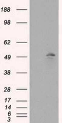 Western Blot: KIAA1609 Antibody (5D9) [NBP2-02352] - HEK293T cells were transfected with the pCMV6-ENTRY control (Left lane) or pCMV6-ENTRY KIAA1609 (Right lane) cDNA for 48 hrs and lysed. Equivalent amounts of cell lysates (5 ug per lane) were separated by SDS-PAGE and immunoblotted with anti-KIAA1609.
