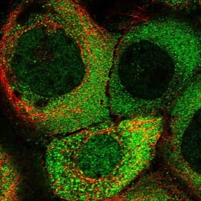 Immunocytochemistry/ Immunofluorescence TLDC1 Antibody - BSA Free