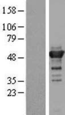 Western Blot: KIAA1609 Overexpression Lysate (Adult Normal) [NBL1-12272] Left-Empty vector transfected control cell lysate (HEK293 cell lysate); Right -Over-expression Lysate for KIAA1609.