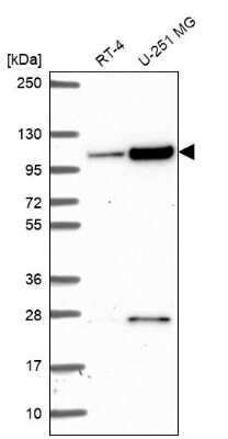 Western Blot: KIAA1614 Antibody [NBP2-56291] - Analysis in human cell line RT-4 and human cell line U-251 MG.