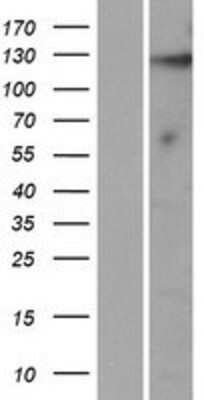 Western Blot KIAA1614 Overexpression Lysate